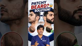 Patchy Beard Kyu Aati Hai? 😱 Beard Grow Nahi Ho Rahi? Solution Inside!