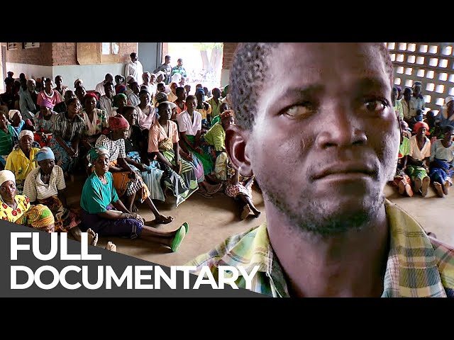 Unreported World: Malawi - Treating Blind People & South Africa - Skin Bleaching | Free Documentary class=