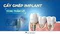 Video for Nha khoa Nhân Tâm - Cấy ghép răng Implant