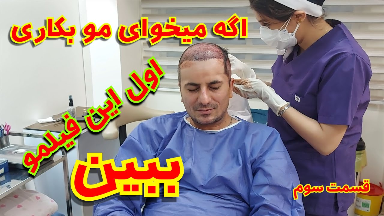 کاشت مو در ایران قسمت سوم 😱 ازهمه چی فیلم گرفتم 😱جواب تمام سوالهای شما ...