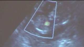 Ohio House passes heartbeat bill, it now heads to governor's desk