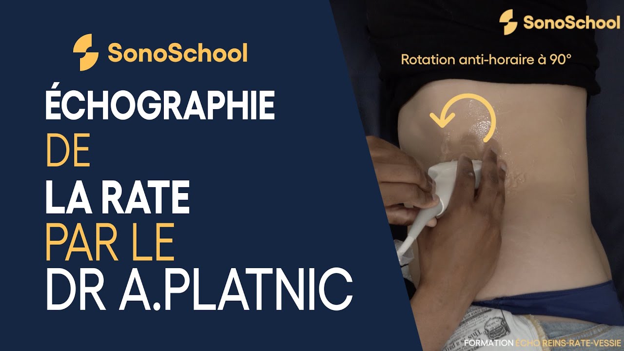 La rate : l'examen échographique par le Dr A.Platnic - iSonic | SonoSchool