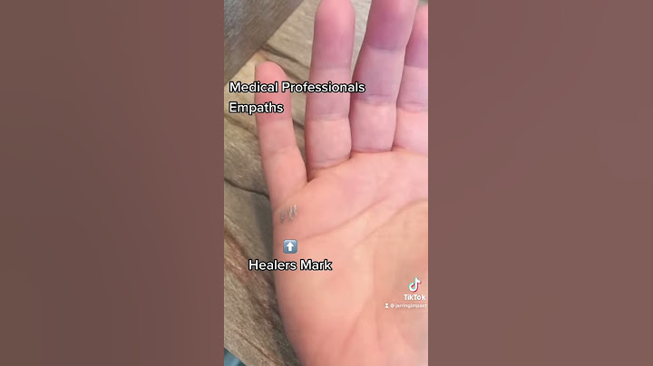 Healers Mark + Palmistry Tip + Palm Reading - DayDayNews