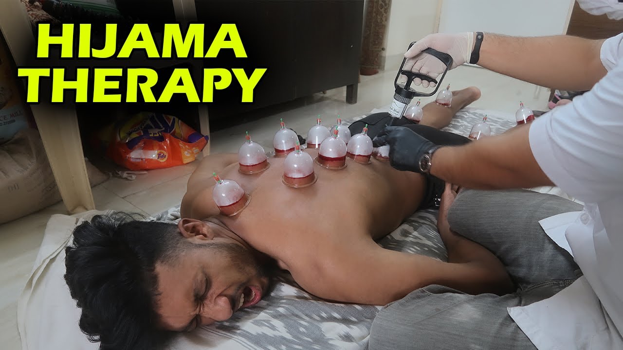 Hijama therapy  wet cupping  for detox your body 