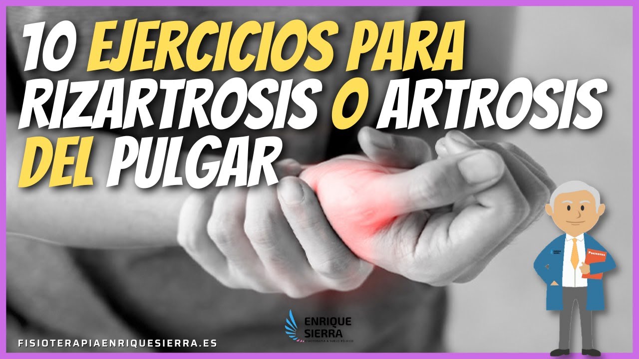 📝 Ejercicios para rizartrosis o artrosis del pulgar de la mano ...