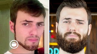 3 Beard Tips Teenagers Must Know Jack Milocco