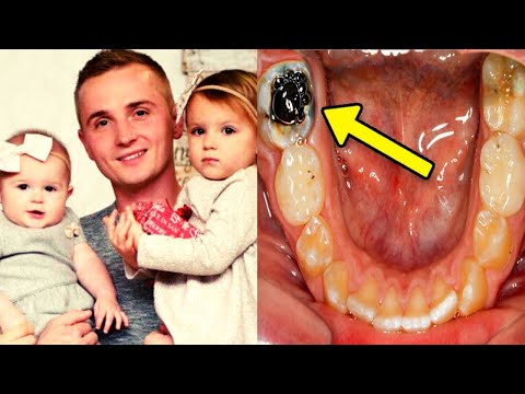 Video: Wat Te Doen Na Het Trekken Van Tanden?