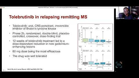 Tirisham Gyang, MD: MS Drugs in the Pipeline and the Newest Research: May 2022