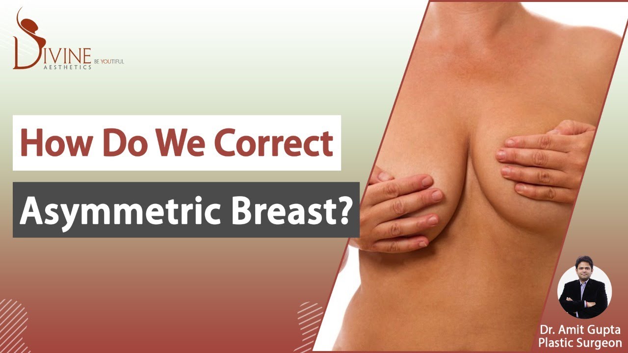 How Do We Correct Asymmetric Breast? #asymmetric #trending #breastimplants  