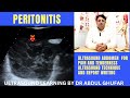 Peritonitis | peritonitis ultrasound | acute abdomen ultrasound | abdominal ultrasound | bowel usg
