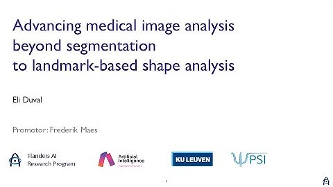 Advancing medical image analysis beyond segmentation to landmark-based shape analysis