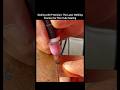 Sealing with Precision: The Laser Welding Process for Thin Tube Sealing.