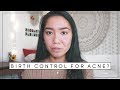 How The Pill Affected My Skin | Acne Update