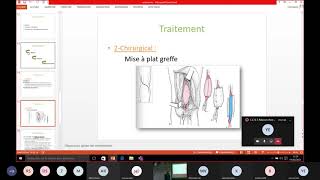 Visioconf - Ccvt Anévrisme