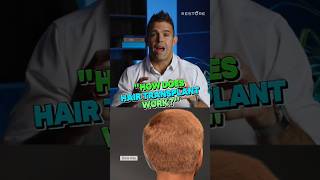 🤔 How does Hair Transplant work?