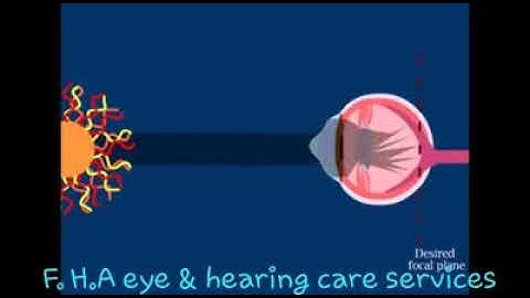 Bệnh giác mạc hình chóp | YTVN.VN