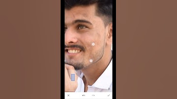 How to snapseed healing Remove Pimple Editing  Best Tutorial Style #shotrs #photoediting #snapseed