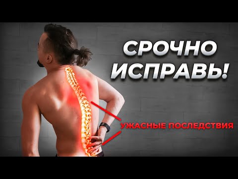 Избавься от БОЛИ в ПОЯСНИЦЕ раз и навсегда - Главные причины