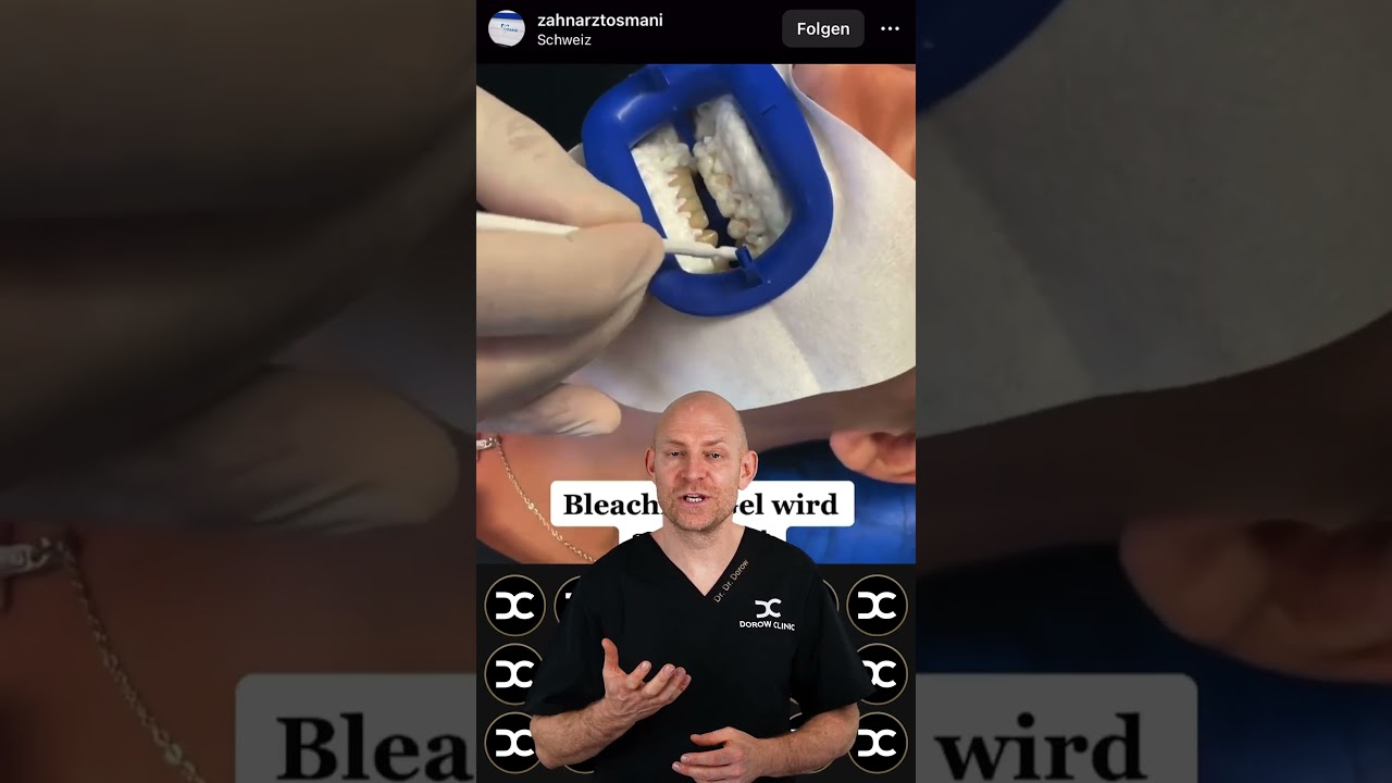 Ultraweiße Zähne mit Philips Zoom Bleaching 