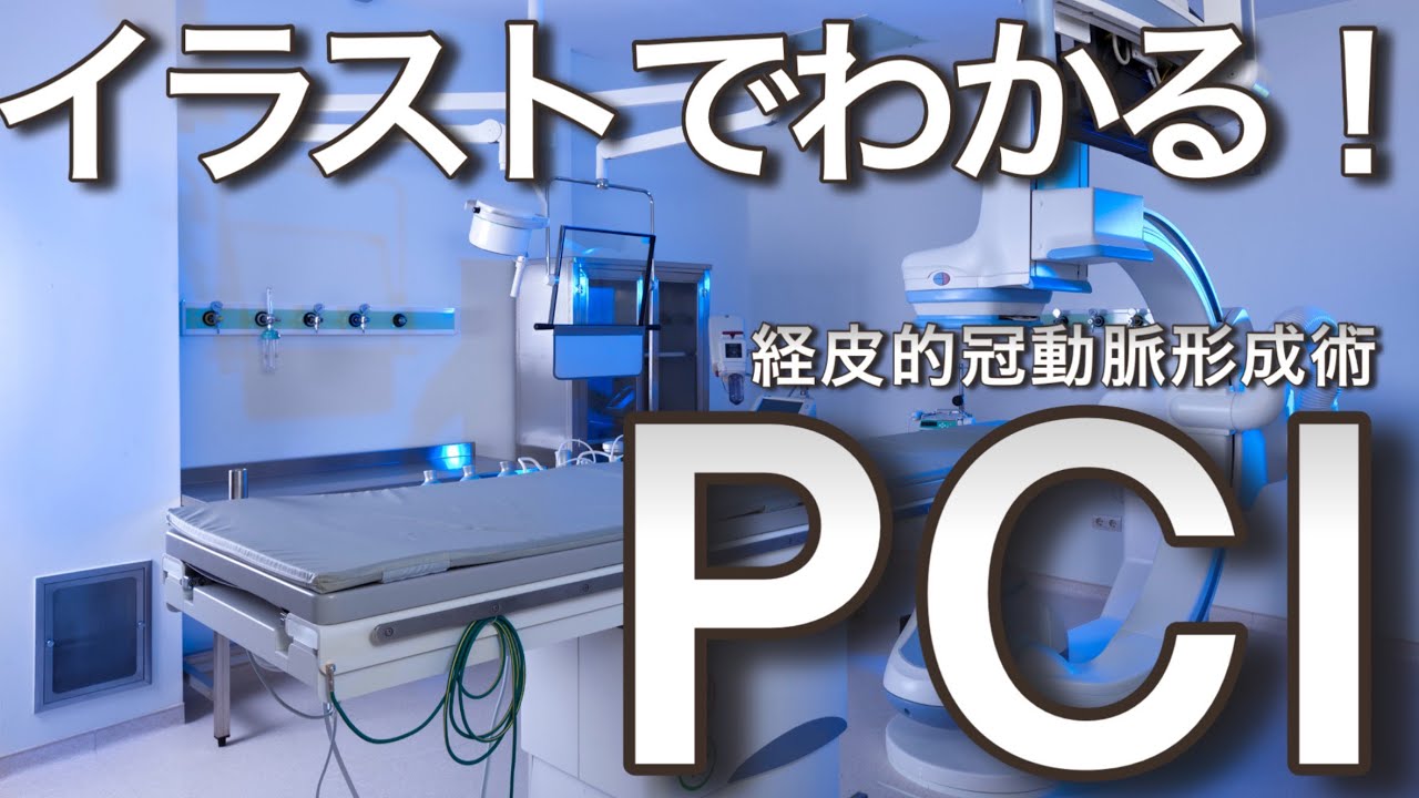 心筋梗塞に対する経皮的冠動脈形成術 PCIについて