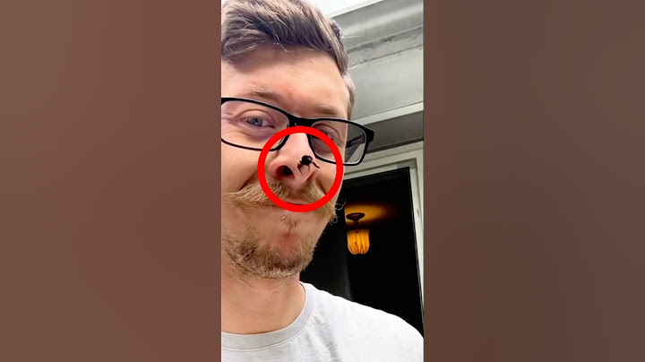 Dit is PIJNLIJK!😨 #viraal #voorjou #nederlands #shorts #shortvideo #trending
