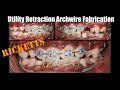 Ricketts utility retraction archwire fabrication and activation