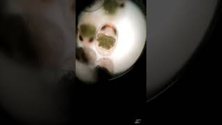 SHRIMP EGGS ON MICROSCOP