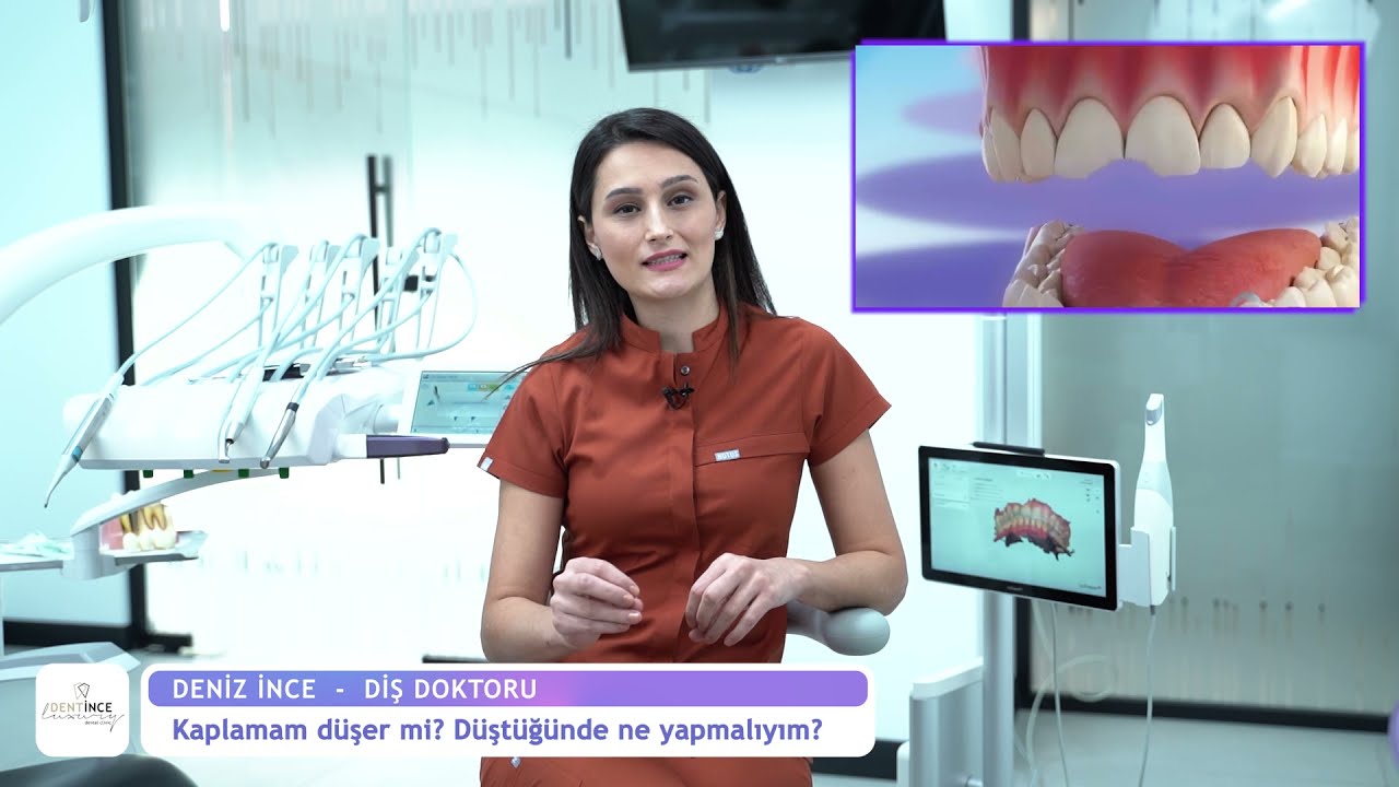 Diş Kaplamam Düştü Ne Yapmalıyım?