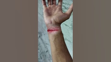 slit wrist vfx compositing breakdown| nuke | mocha |  photoshop