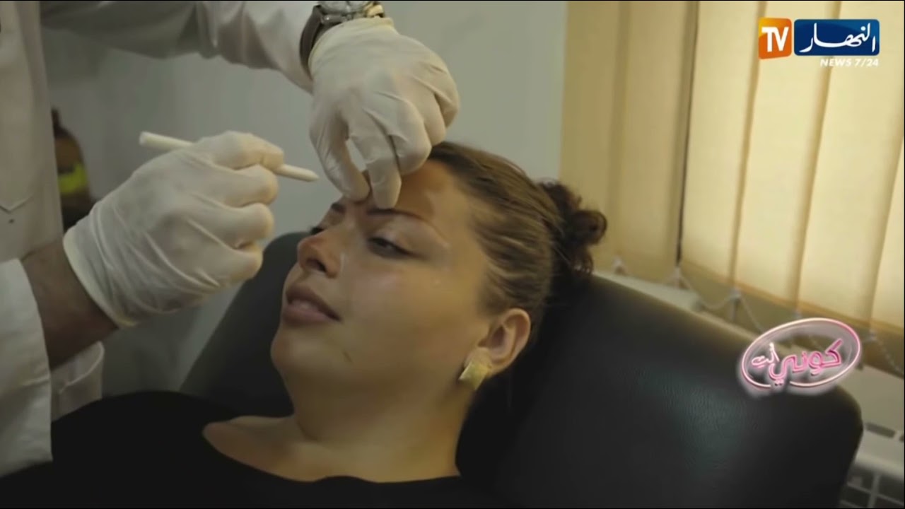 فيلر و بوتوكس ليسمين Filler et Botox pour Yasmine @Ennahartvonline
