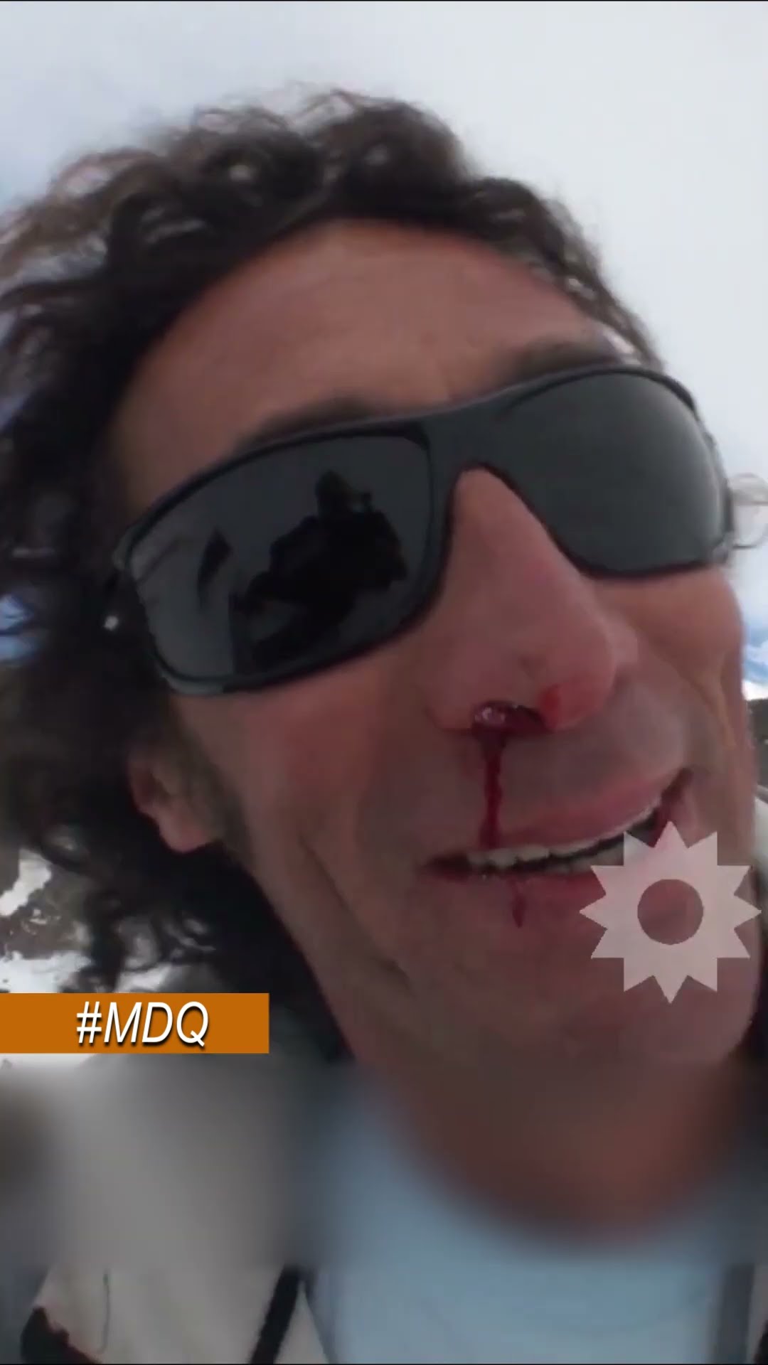 ¡EUGENIO SE PEGÓ UN GOLPAZO HACIENDO SNOWBOARD! #MDQ LA PASÓ MAL EN EL VOLCÁN COPAHUE