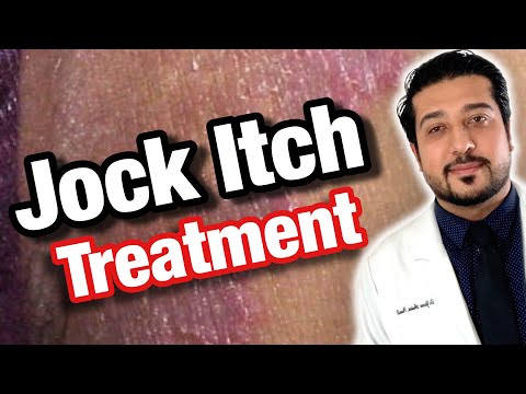 Vídeo: Jock Itch Que No Desaparecerá: Causas Y Tratamientos