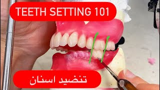 Setting full denture teeth in wax (implant case)/تنضيد اسنان علوية وسفلية في الشمع #waxbae