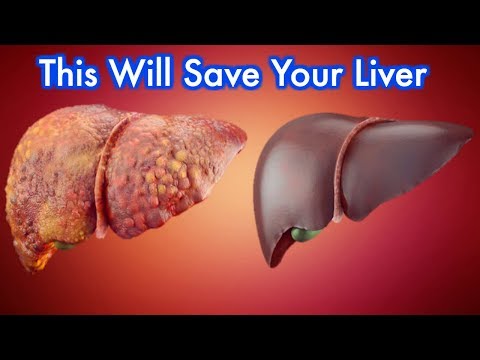 liver-detox---eat-these-10-foods-that-naturally-cleanse-your-liver