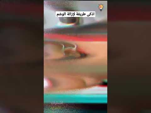 طريقة ازالة الوشم بالليزر التي ادهشت الجميع 
