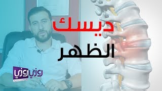 علاج الانزلاق الغضروفي – ديسك الظهر