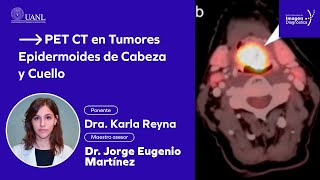 PET CT en Tumores Epidermoides de Cabeza y Cuello por la Dra. Karla Reyna de la Garza.