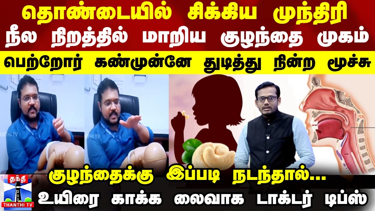 Health தொண்டையில் சிக்கிய முந்திரி..நீலமாக மாறிய குழந்தை முகம் - துடித்து நின்ற மூச்சு