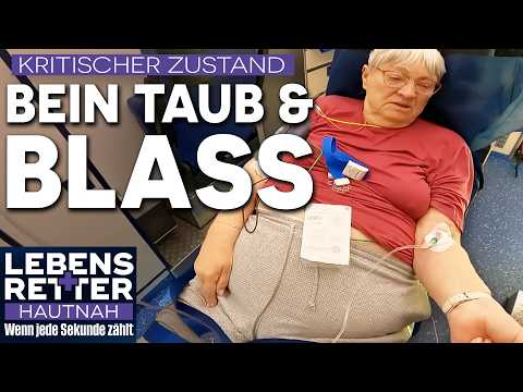 Severe leg pain: Suspected acute vascular occlusion | Life Savers up close