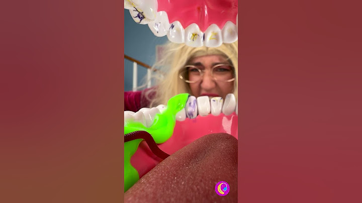 لقد فقدت سني بسبب الحلوى 🍬😭🦷