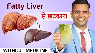 लीवर की सारी बीमारियों से छुटकारा पाएं | Get Rid Of Fatty Liver Without Medicine - Dr. Vivek Joshi