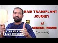  hair transplant  journey  step by step  genesis hair transplant centre indore