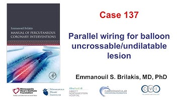 Case 137: PCI Manual - Balloon uncrossable and balloon undilatable lesions