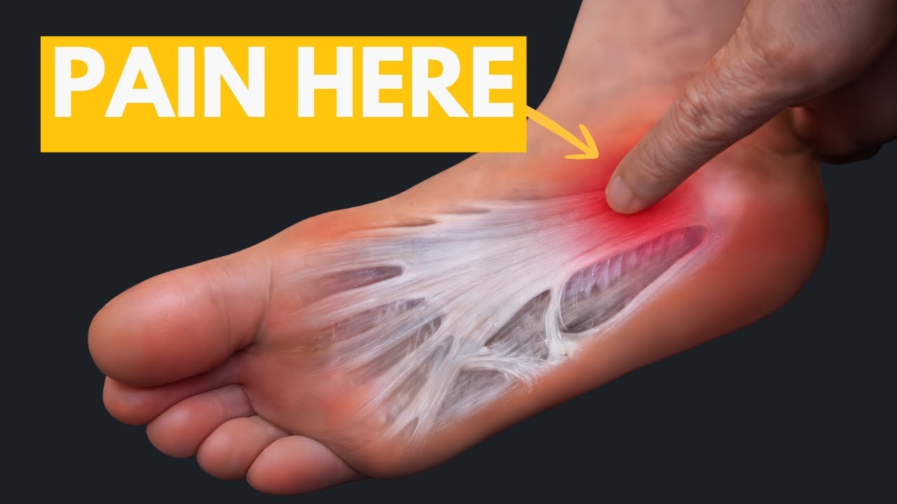 Подошвенный фасциит: 3 шага для уменьшения боли: утренняя рутина