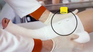 UrgoK2 Dual Layer Compression System Application Video