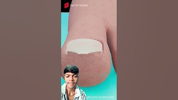 Truth About Ingrown Nails: Explained in 3D Animation #shorts #animation #trustonallah