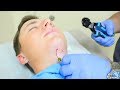 Hook In My NECK (Painful)