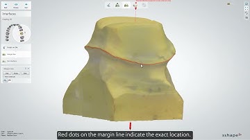 Performing a single coping design