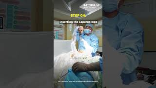 Inside the Lab: Understanding the Laparoscopy Procedure | Indira IVF | Procedure Video