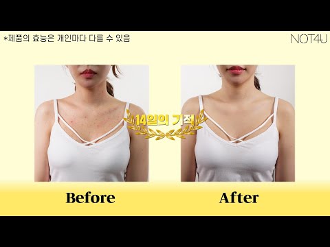 내 몸이 깨끗해지는 14일의 기적,, 이젠 당당하게 노출하자!│클리어 바디미스트